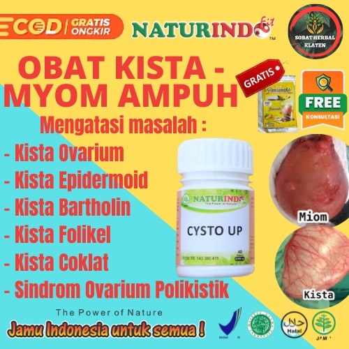 OBAT HERBAL KISTA CYSTA MYOM KISTA OVARIUM KISTA EPIDORMEID KISTA ATEROMA KISTA PILONIDAL KISTA GINJ