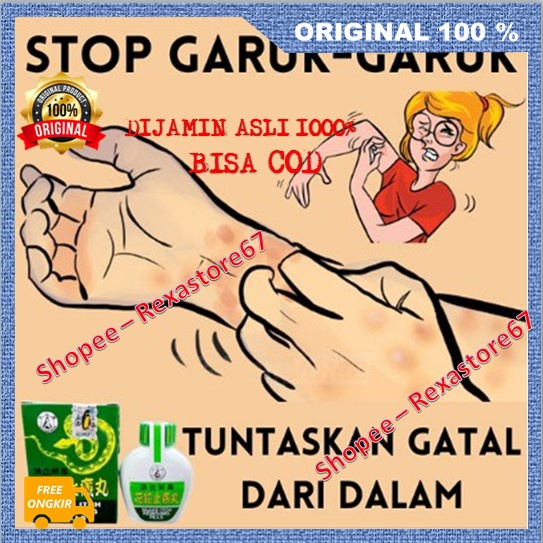 [BISA COD] Ramuan Cina Snake Itch Biduran Eksim Ampuh 100% ASLI