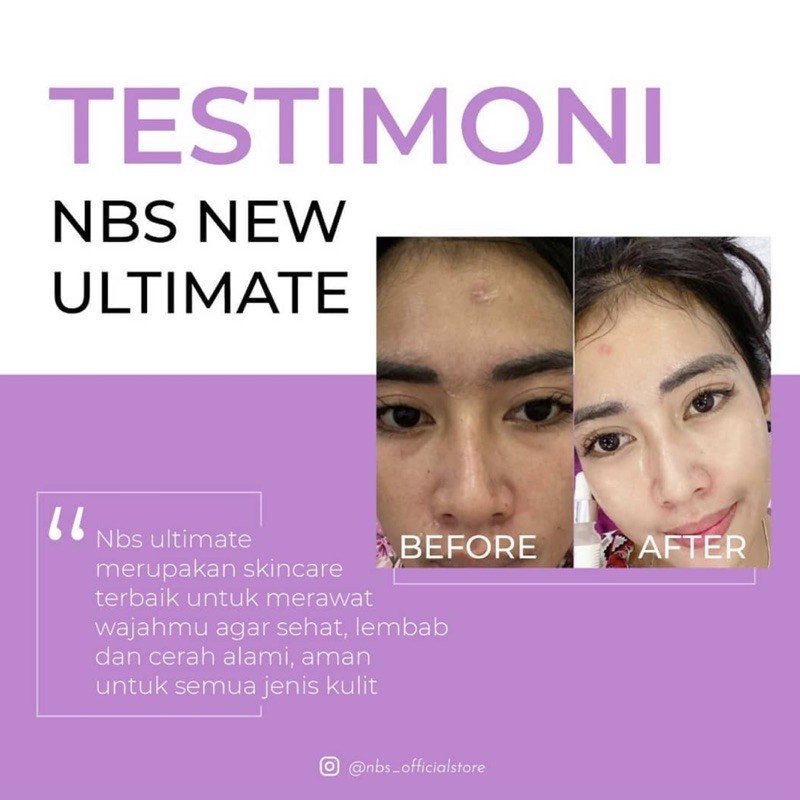 NBS EXTRA GLOW NEW PAKET NBS PEMUTIH WAJAH PENGHILANG FLEK JERAWAT KUSAM CREAM NBS ULTIMATE ORIGINAL BPOM-4