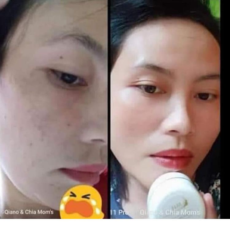 COD ®PAKET LENGKAP MH WHITENING SKIN ☃➠ (Laris)