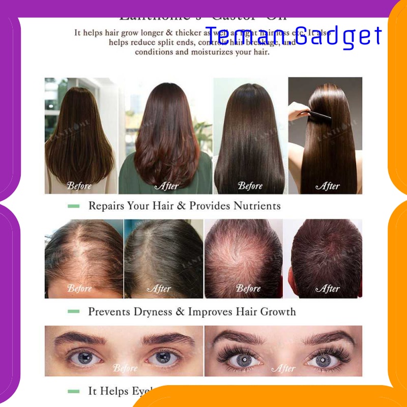 TG-FE194 LANTHOME CASTOR SERUM PENUMBUH RAMBUT ORGANIC HAIR GROWTH OIL 10ML