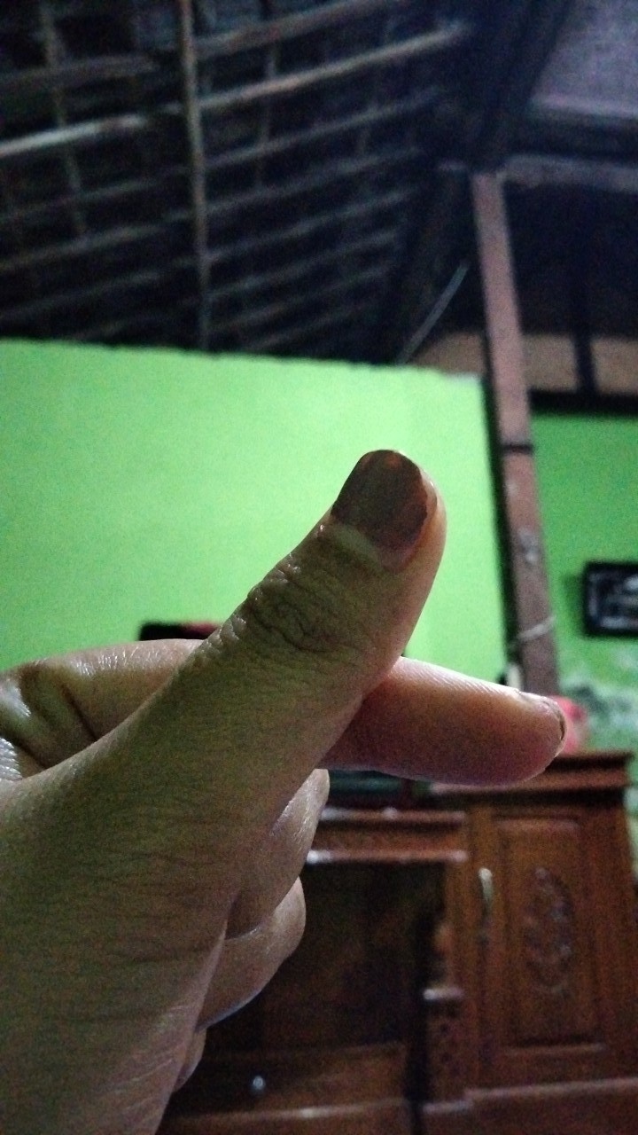 Detergen Attack Easy