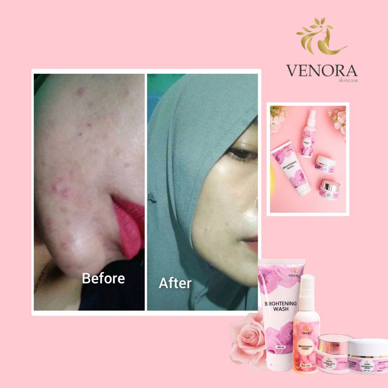 [READY ECER] NORMAL NIGHT CREAM VENORA SKINCARE CREAM MALAM VENORA