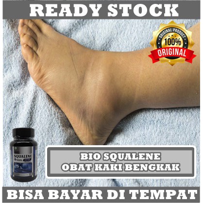 Obat Pergelangan Kaki Bengkak, Kaki Terkilir, Kaki Keseleo, Nyeri Tumit, Engkel Kaku, dengan Bio Squalene 100% ORIGINAL