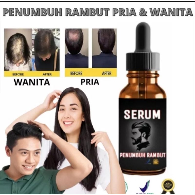 Serum penumbuh rambut / penumbuh rambut secara cepat / vitamin rambut rontok / obat penumbuh rambut / perawatan rambut wanita /pria