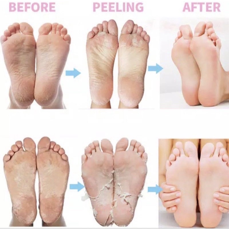 EFERO FOOT MASK PEELING EXFLOATING EFERO / MASKER KAKI PENGELUPASAN KULIT MATI, MENGHALUSKAN KULIT DAN MEMPERCANTIK KAKI