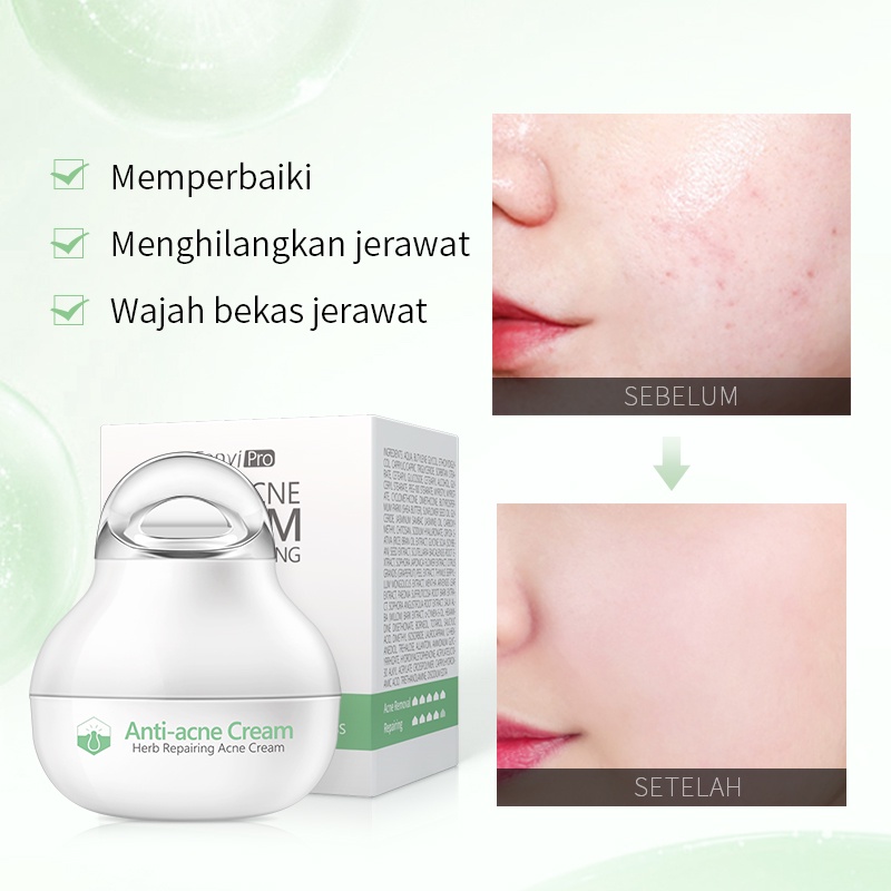 Fenyi Herbal Acne Cream Perawatan Jerawat Penghilang Jerawat Anti Kemerahan 8g