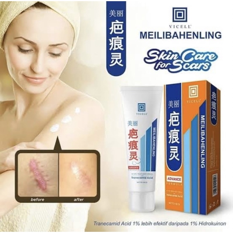 [BPOM] VICELL SKIN SOLUTION CREAM ORIGINAL 60GR PENGHILANG BEKAS LUKA