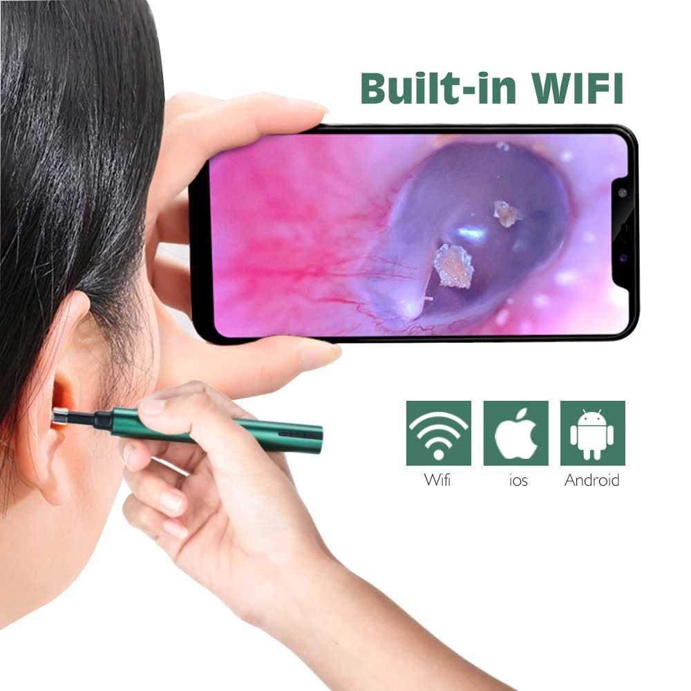 Ear Camera Endoscope For i phone Smart Visual Pembersih Telinga Korek Kuping Dengan Kamera Konek WiFi Lensa 5.5mm