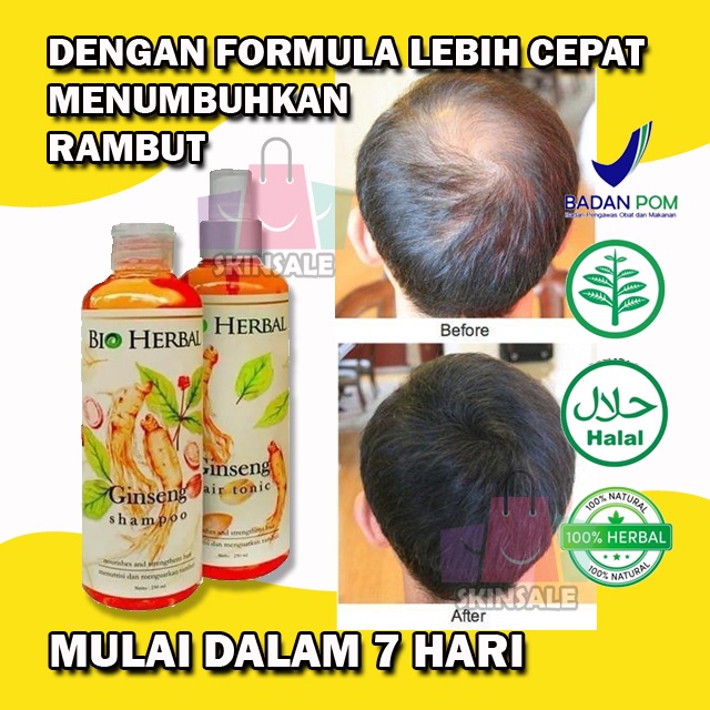 PENUMBUH RAMBUT BOTAK BIO HERBAL OBAT PENUMBUH RAMBUT BOTAK PRIA MINYAK PENUMBUH RAMBUT BOTAK OBAT R