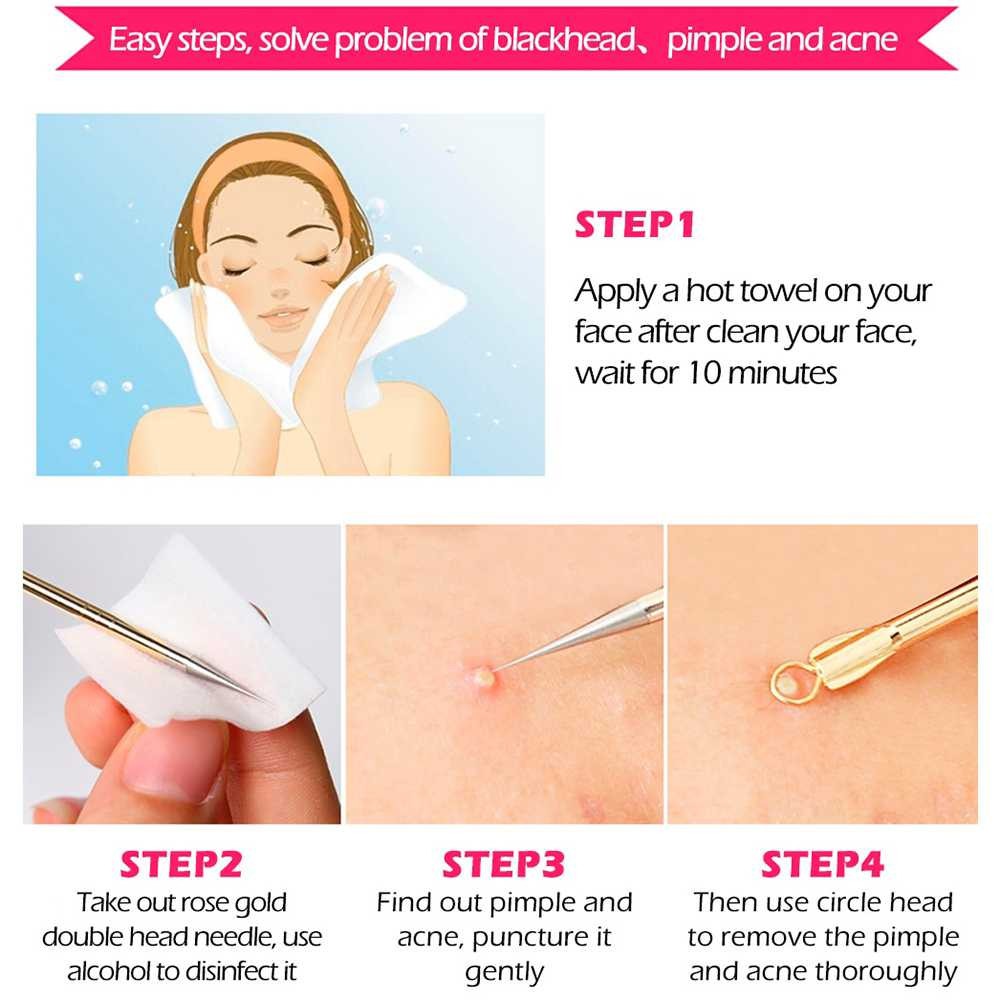 Perlengkapan Perawatan Wajah Stainless Steel Peralatan Muka Anti Jerawat&amp;Komedo 4PCS Aman Digunakan