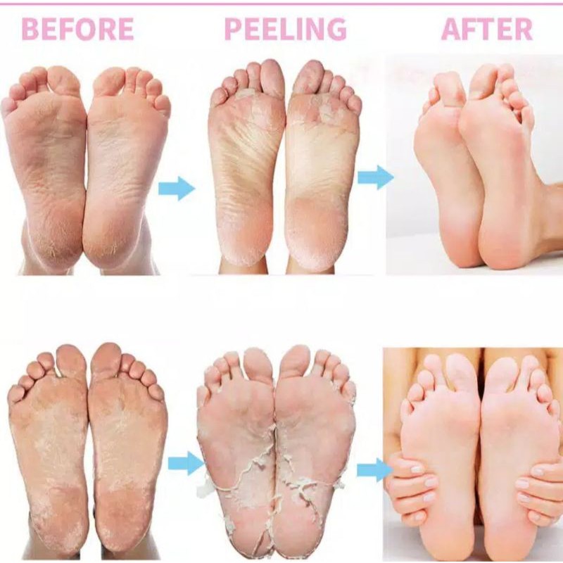 EFERO FOOT MASK masker kaki foot peeling foot exfloating efero exfoliating