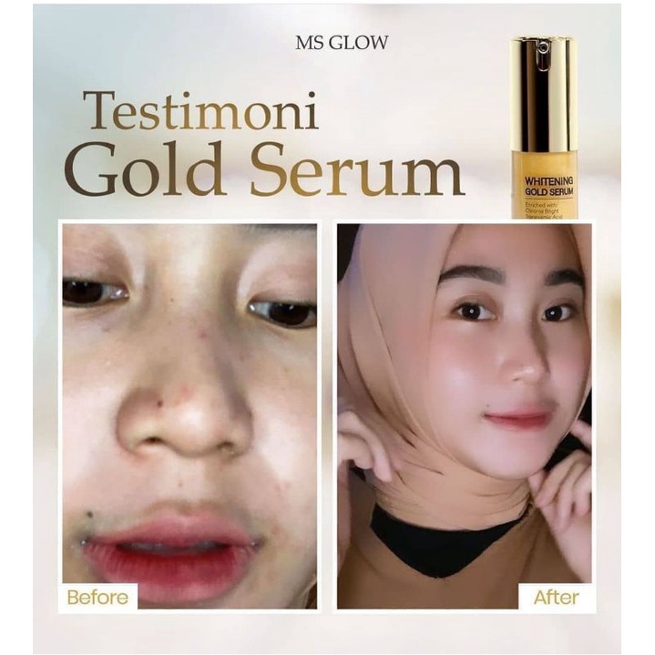 Serum Gold Whitening MS GLOW.