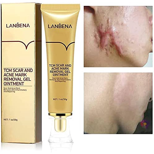 LANBENA TCM Scar and Acne Mark Removal Gel Ointement 30g Penghilang Bekas Jerawat &amp; Luka