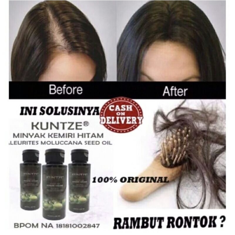 (BPOM) MINYAK KEMIRI PENUMBUH RAMBUT BOTAK PENUMBUH BREWOK PENUMBUH ALIS