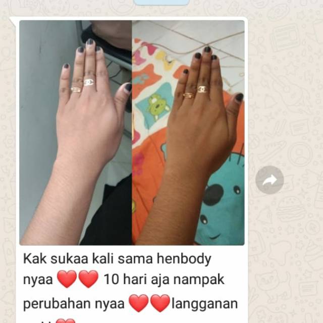 Handbody Overwhite setara suntik putih