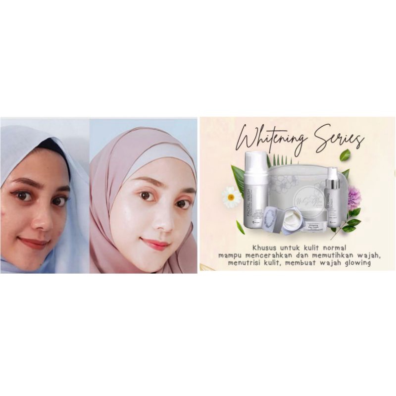 CREAM PEMUTIH/PAKET WHITENING MS GLOW/WHITENING MS GLOW/MS GLOW/MS GLOW WHITENING