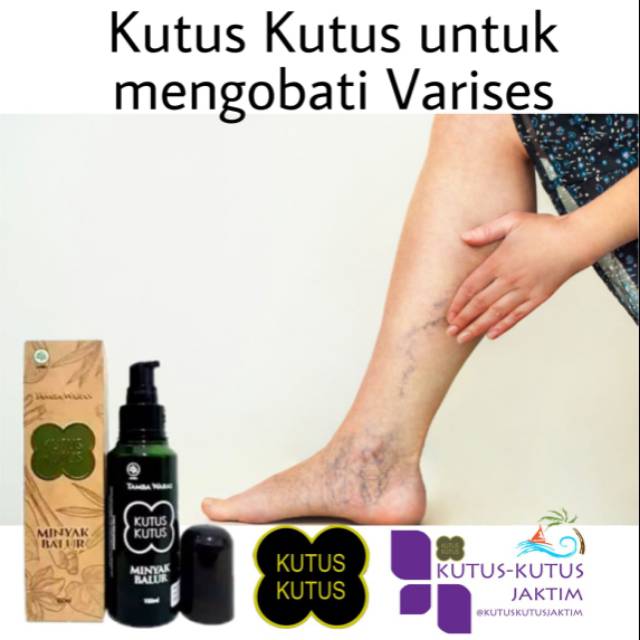 Jual Kutus Kutus Untuk Mengobati Varises Indonesia Shopee Indonesia