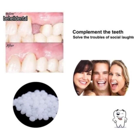 Temporary tooth repair / temptooth / gigi palsu buat sendiri /lem gigi padat