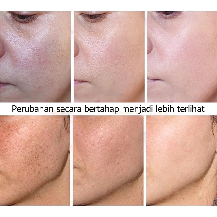 krim penghilang melasma Krim Pemutih Wajah Krim Penghilang Bintik Hitam 30g meringankan melasma dan bintik-bintik Mencerahkan kulit Mengurangi kulit kusam