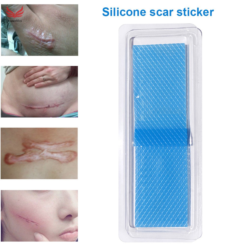 silicone based scar treatment sheets