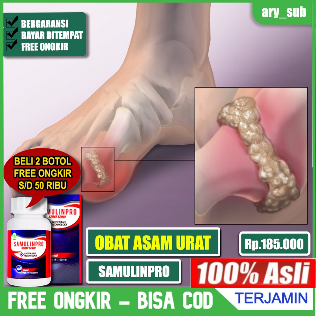 

Obat Khusus Asam Urat, Nyeri Sendi Rematik, Sendi Kaku Herbal Samulinpro Kapsul Asli 100% Original