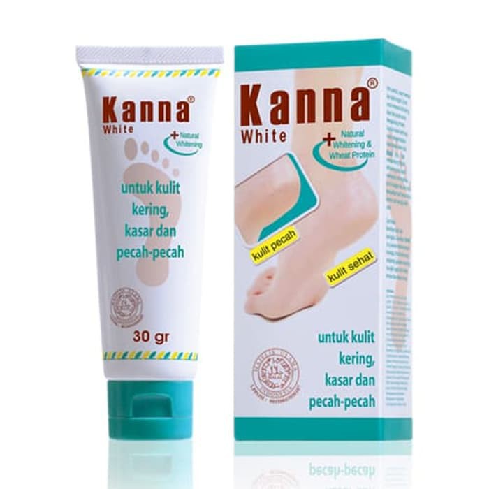 KANNA Krim White   Krim Kaki Pecah pecah ( Ekstra Whitening ) - 15gr/30gr