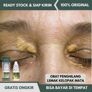 Jual Xanthelasma Oil Kode V9324 Indonesia Shopee Indonesia