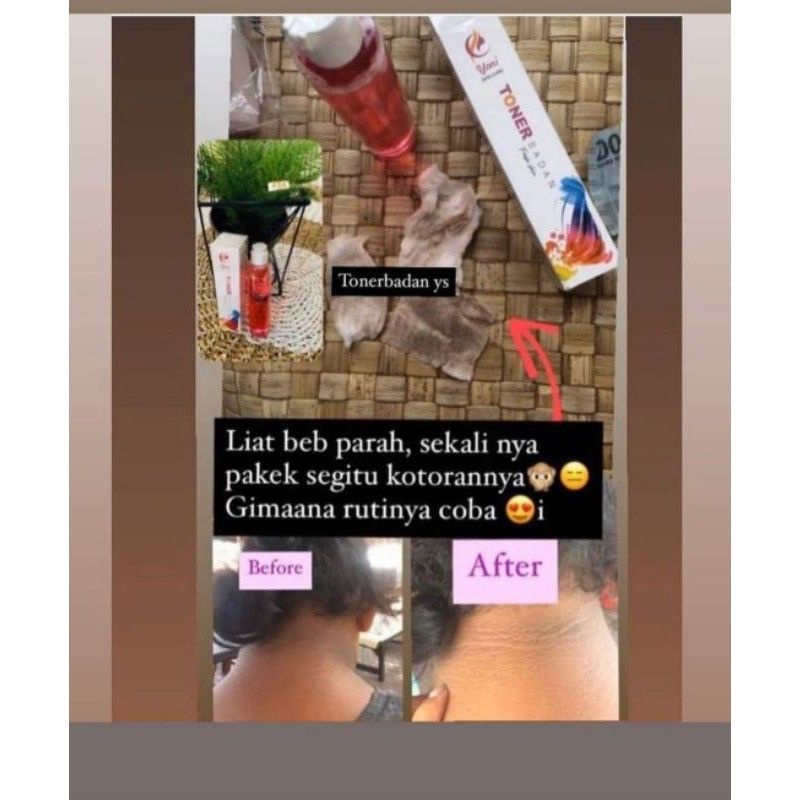 ‼️READY‼️TONER BADAN YONI SKINCARE BPOM/PENGHILANG DAKI