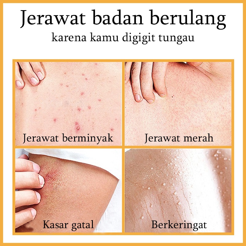 Gel mandi Sabun mandi jerawat cair pemutih badan Acne body wash Whitening body wash Menghilangkan tungau dan jerawat Pemutih kulit Banyak nutrisi Pembersihan lembut Mengangkat kotoran kulit dan sel kulit mati