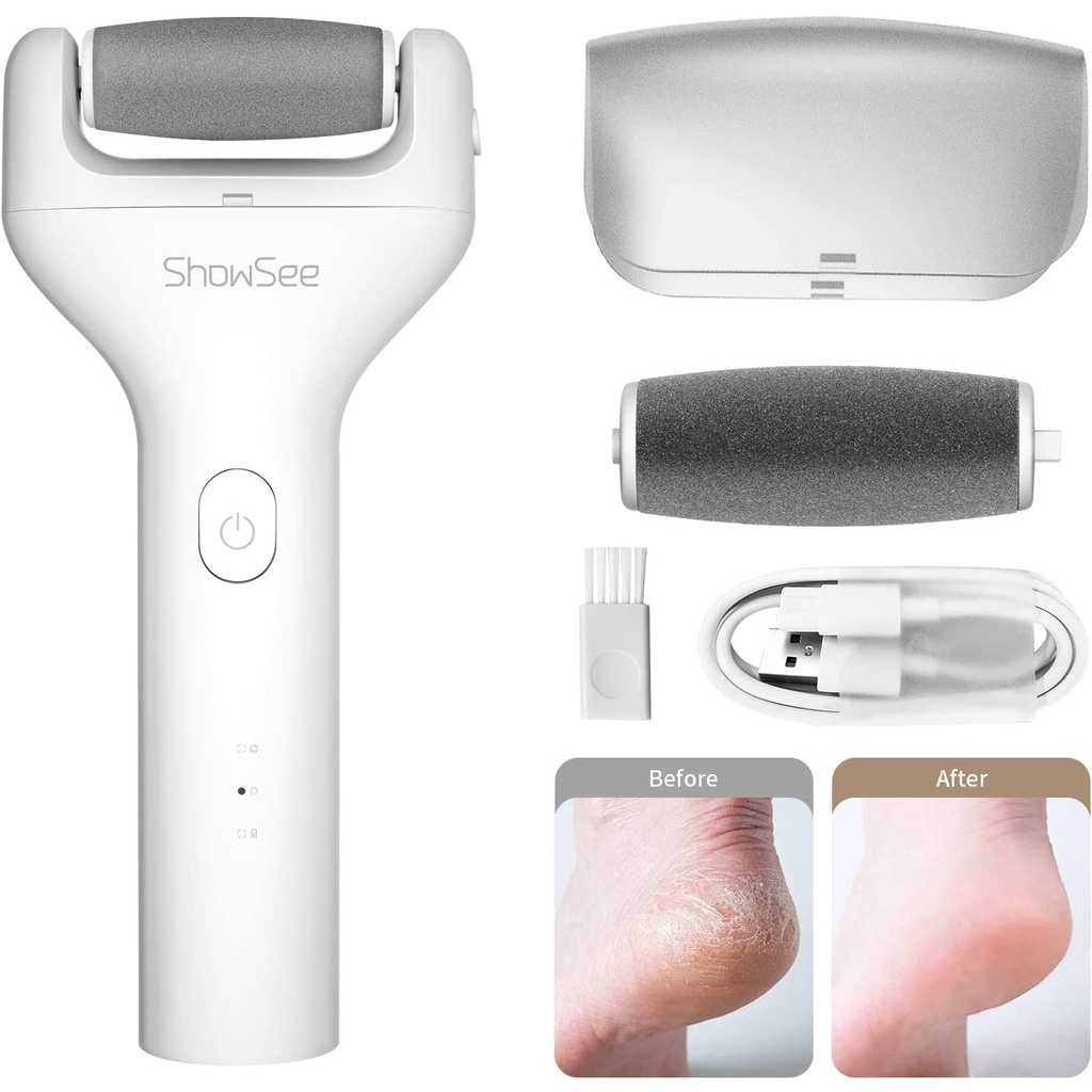 ShowSee Callus Remover Electric Pedicure Dead Skin Remover for Feet