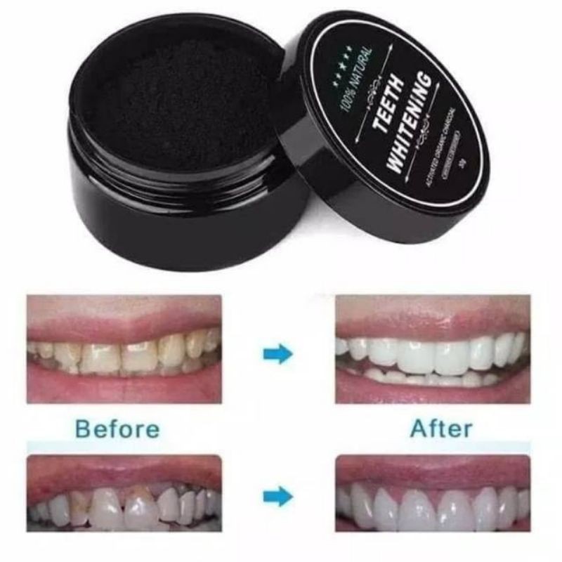 TEETH WHITENING/ PEMUTIH GIGI 30gr