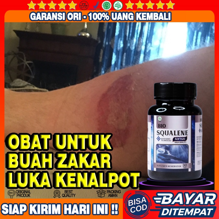 Obat Luka Kena Knalpot - Herbal Luka Knalpot - Obat Luka Melepuh Terkena Knalpot - Obat Luka Bakar K
