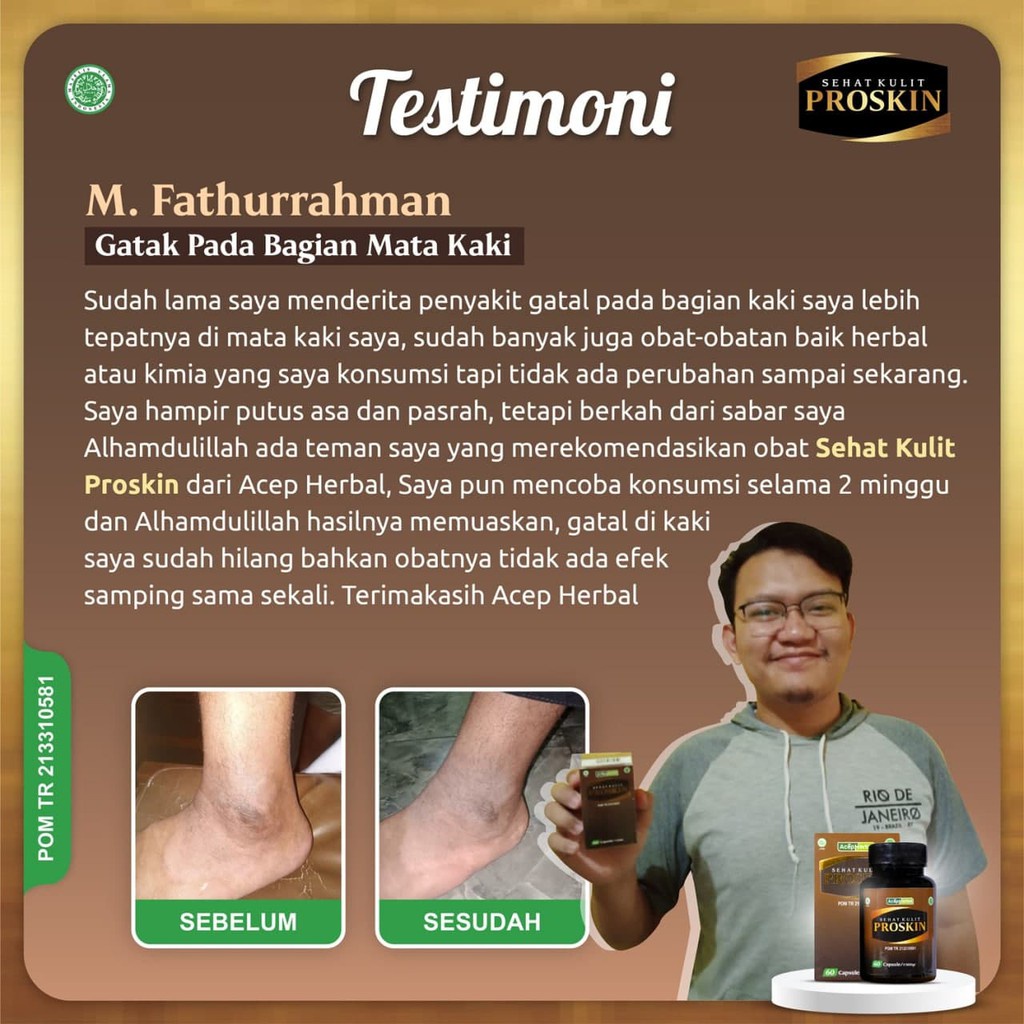 Obat Badan Gatal-Gatal, Obat Gatal Gatal Seluruh Badan, Obat Gatal Alergi, Obat Gatal Menahun, Obat Kulit Bersisik, Obat Gatal Kulit, Obat Gatal Merah-Merah, Obat Psoriasis, Obat Eksim Kering, Obat Gatal Berair, Obat Koreng Gatal Dengan Proskin