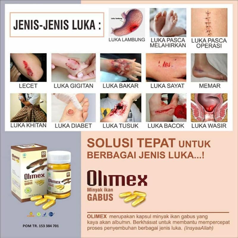 Kapsul Olimex Extrak Minyak Ikan Gabus Membantu Penyembuhan Luka Atau Pasca Operasi 100% Extak Minyak Albumin