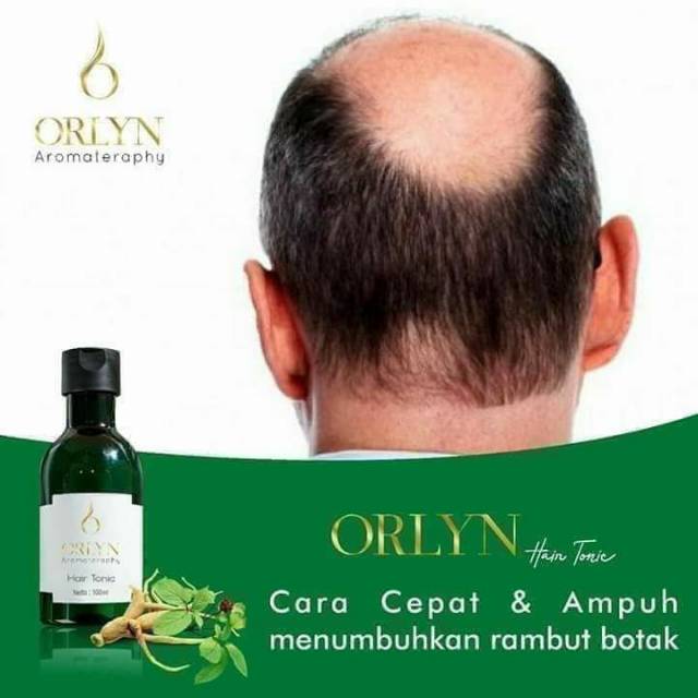 Orlyn