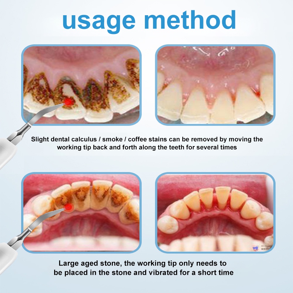 2 IN 1 Alat Pembersih Tartar Sonic Listrik IPX67 Tahan Air 3 Mode Pembersihan Perawatan Mulut Universal Untuk Anak-anak Dan Dewasa