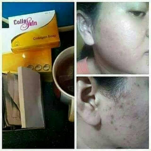 Jual Collaskin Collagen Nasa Shopee Indonesia