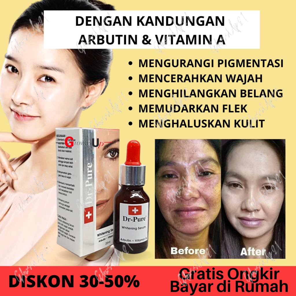 SERUM PENCERAH WAJAH PENGHILANG BEKAS JERAWAT DR PURE SERUM WHITENING BPOM ORIGINAL