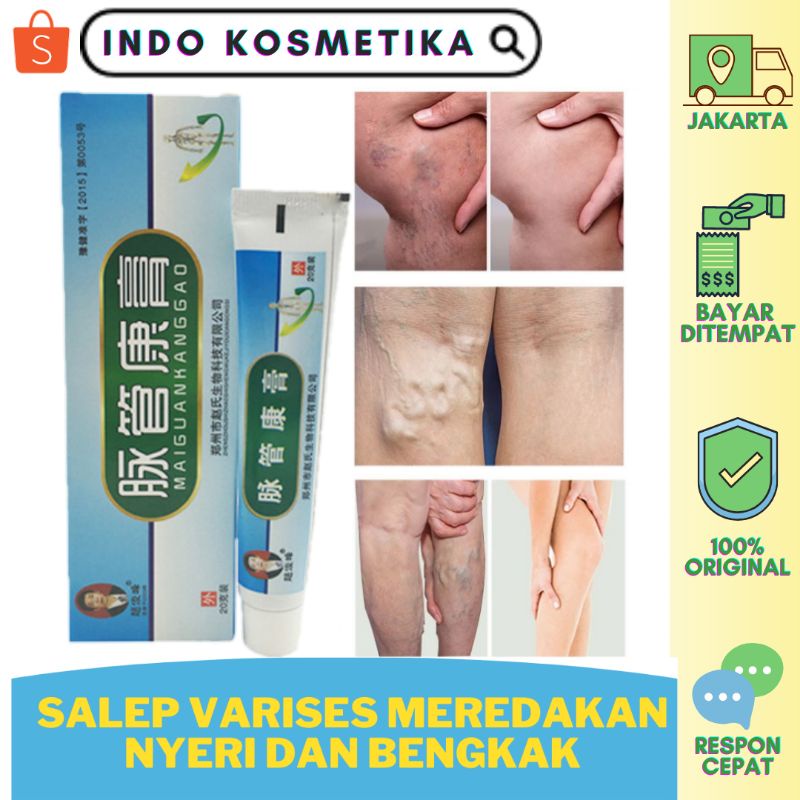 SALEP VARISES OBAT HERBAL CINA MAIGUANKANGGAO