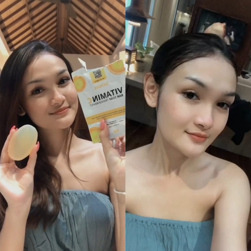 Paket Hemat isi 3 Sabun Skinian Treatment Bar Soap dan Skinian Vitamin C - Sabun Viral Tiktok Sabun Pemutih Badan BPOM Penghilang Bekas Luka Penghilang Flek Hitam Plek Item Penghilang Bekas Jerawat Ampuh Sabun Piral Viral untuk Wajah dan Badan Aman Bagus