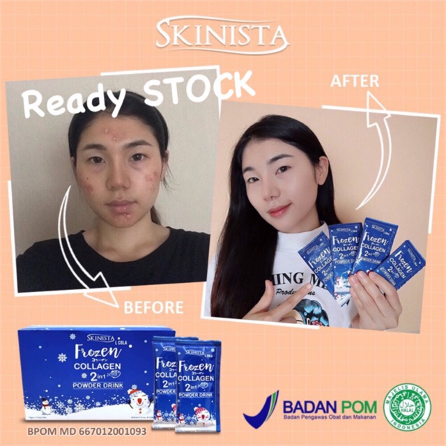 Skinista Frozen Collagen Drink Shopee Indonesia
