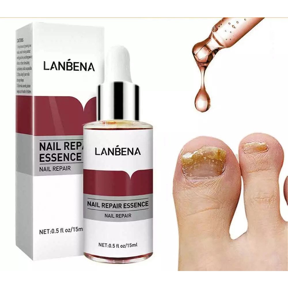 Hope Store - LANBENA Nail Repair Perawatan Esensi Serum Jamur Kuku Essence Oil Serum Nail Treatment