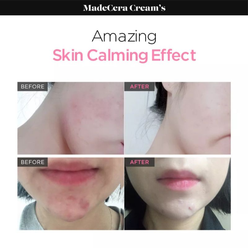 SKINRX LAB MadeCera Cream (PO)