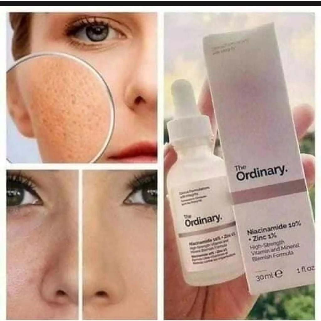 THE ORDINARY NIACINAMIDE 10% + ZINC 1% 30ML ORIGINAL