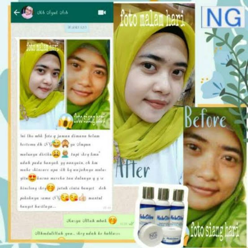 Paket Nalu Glow BPOM normal /acne / flek