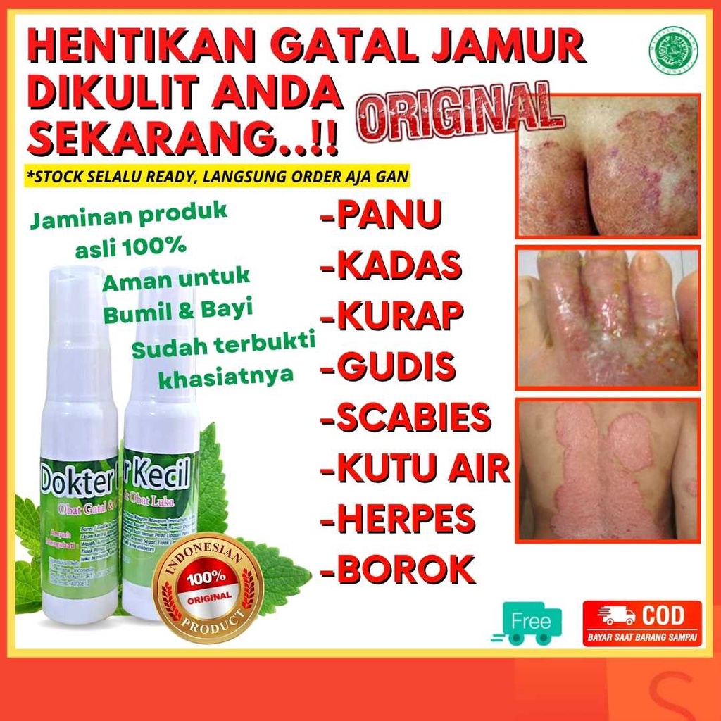 Obat Salep Gatal Jamur Kulit Selangkangan Dan Kemaluan Eksim Paling Ampuh Mengatasi Kulit Gatal ORIG