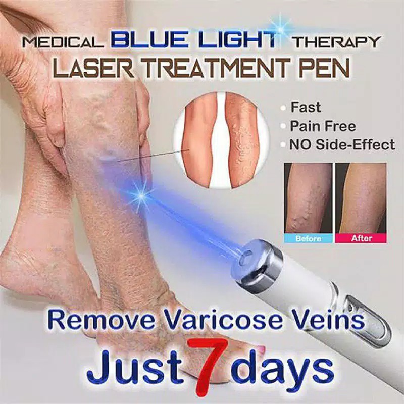 Acne Laser Pen Facial Massager Treatment Soft Scar