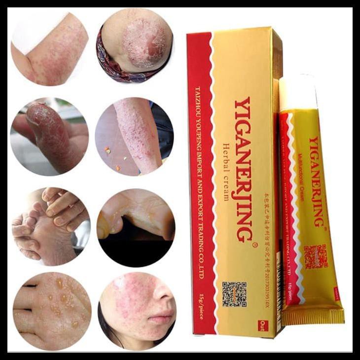 Salep Yiganerjing | Cream Yiganerjing 15Gram | Salep Eksim Jamur Psoriasis Dermatitis | Salep Herbal