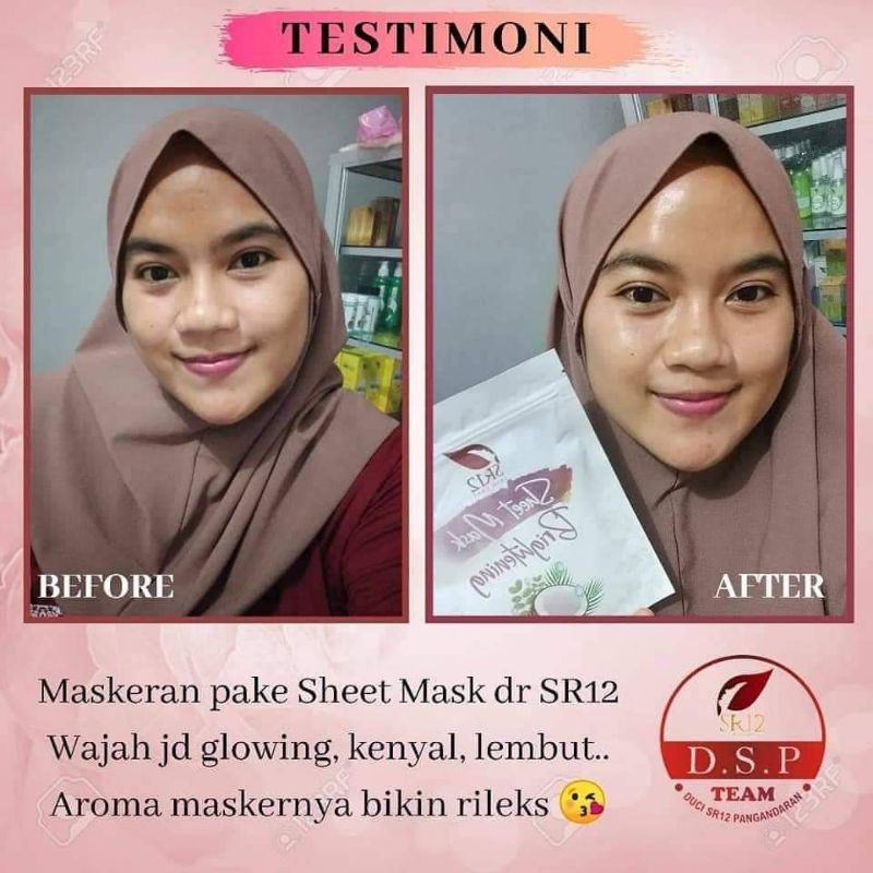 Sheet Mask SR12 - sheetmask brightening sr12 - sheetmask acne sr12 - Acne dan Brightening